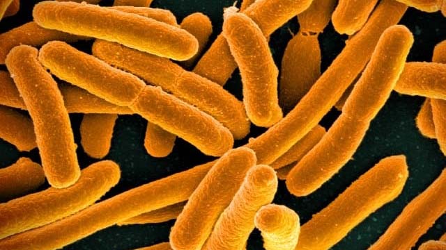 E.coli under a microscope