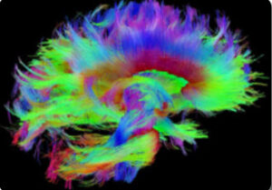 Brain Initiative - Hyperpolarization lab